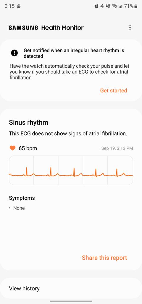 Ecg Samsung Galaxy Watch Health Features Samsung Galaxy Watch